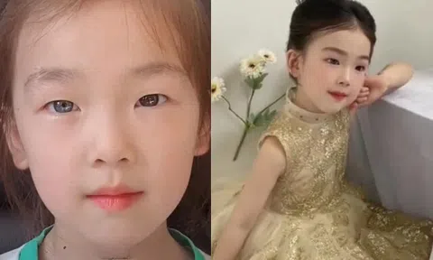 Bé gái 6 tuổi nổi tiếng sau một đêm vì có đôi mắt “kỳ lạ”, gia đình bật khóc khi nghe bác sĩ kết luận