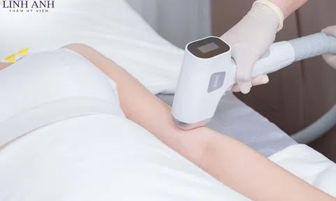 Triệt lông tại Thẩm mỹ viện Linh Anh – Nơi khởi đầu cho làn da sạch, sáng, mịn