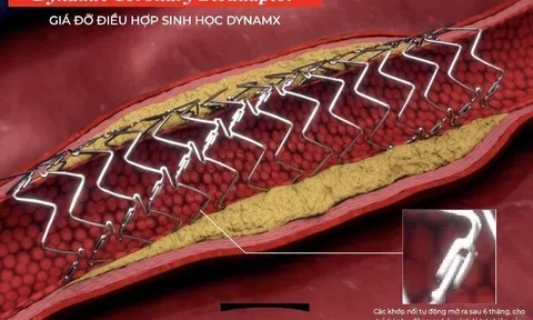 Stent tương thích sinh học thế hệ mới giảm biến chứng tim mạch đáng kể so với stent phủ thuốc hiện đại