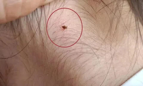 Phát hiện sinh vật lạ cắn vào cổ con gái 4 tuổi, người mẹ vẫn “từ chối” hai lần cứu con và cái kết không ngờ