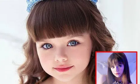 Bé gái nổi tiếng thế giới bị người lạ làm phiền vì quá xinh đẹp, 10 năm sau dậy thì xong nhan sắc thay đổi lớn