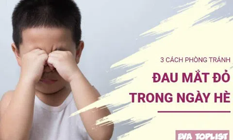 Giữ đôi mắt bé an toàn: 3 bí quyết phòng ngừa đau mắt đỏ mùa hè hiệu quả