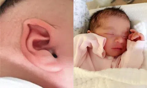 Bé trai sinh ra có đôi tai “biến dạng”, gia đình lo lắng đưa đến bệnh viện, nghe bác sĩ nói người mẹ bật khóc