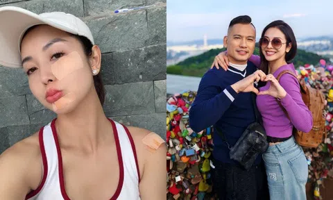 Hoa hậu Jennifer Phạm trầy hết nửa mặt vì ngã khi chơi pickleball, dân mạng bày tỏ "không phải chồng mà nhìn còn xót"