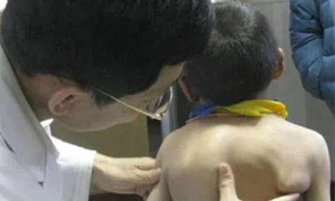 Mẹ phát hiện lưng con ngày càng biến dạng, biết nguyên nhân do thói quen của bà nội, người mẹ hối hận