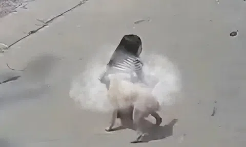 Bé gái 5 tuổi bị chó nhà hàng xóm bất ngờ tấn công, húc ngã xuống đất khi đi bộ trên đường, phải nhập viện gấp