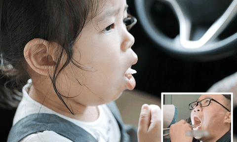 Trẻ bị hóc xương cá, bác sĩ khuyên cha mẹ nhanh chóng cho thêm một thứ vào miệng con nhưng không được nuốt