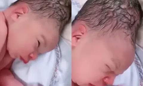 Bé sơ sinh chào đời có hình dáng đầu kỳ lạ, gia đình vừa nhìn thấy đứa trẻ đã sợ không dám bế