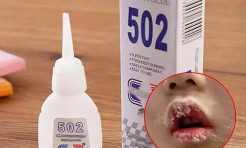 Con nếm thử keo 502 bị dính chặt môi, mẹ bình tĩnh xử lý thông minh khiến bác sĩ cũng phải khen ngợi