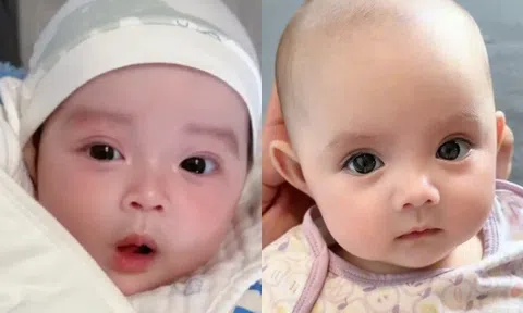 Loạt ảnh chào đời "gây rúng động" của những em bé sơ sinh, đẹp như tạc tượng khiến bác sĩ cũng ngỡ ngàng