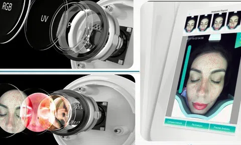 Trải nghiệm soi da AI: Bí quyết phát hiện nám sớm tại thẩm mỹ viện Ngọc Dung