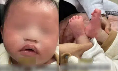 Bé sơ sinh 1 tháng tuổi nhập viện khẩn cấp vì bà nội dùng thứ nước này để pha sữa cho cháu