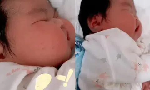 Bé sơ sinh chào đời như “người khổng lồ”, nặng 11kg, hai má phúng phính bánh bao khiến cả bệnh viện xôn xao