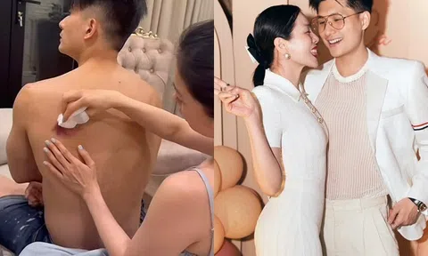 Sao Việt 24h: Lệ Quyên "gây sốt" vì hành động ngọt ngào khi tình trẻ Lâm Bảo Châu bị thương, được ví như "hậu phương vững chắc"