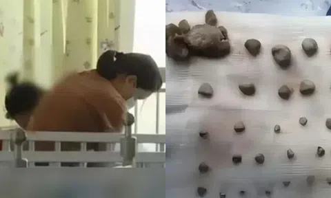 Bé gái 9 tuổi có 56 viên sỏi trong thận, BS chỉ ra nguyên nhân xuất phát từ thói quen sai lầm mà nhiều cha mẹ Việt hay mắc