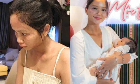 Chi nửa tỷ/tháng để ở cữ, H'Hen Niê nay "biến dạng" ngoại hình vì bệnh lạ sau sinh, chỉ 1/10 người gặp phải