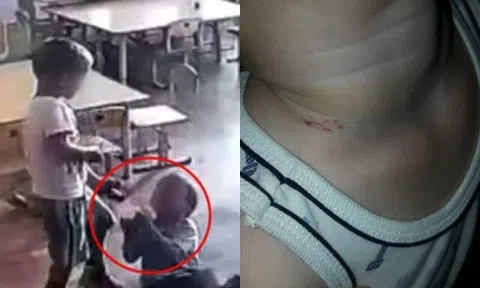 Đón con đi học về thì phát hiện trên cổ bé có vết bầm, kiểm tra camera người mẹ bủn rủn với cảnh tượng giữa lớp