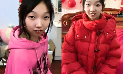 Cô gái ngoại hình khác lạ, cười ngô nghê khi được mẹ ruột chọn chồng và giục sinh con khiến MXH bùng nổ