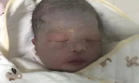 Bé sơ sinh chào đời da tím tái như quả cà, bố sợ không dám đến gần, 3 tháng sau diện mạo gây ngỡ ngàng