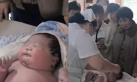 Bé sơ sinh chào đời da vừa đỏ vừa tím, nặng 7kg, y tá bế khỏi phòng mổ cả gia đình hoang mang