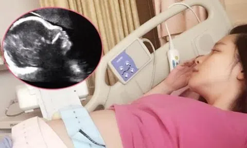 Mẹ bầu đến bệnh viện khám thai mỗi lần đều cho kết quả khác nhau, tá hoả khi nghe bác sĩ kết luận sinh 4 con