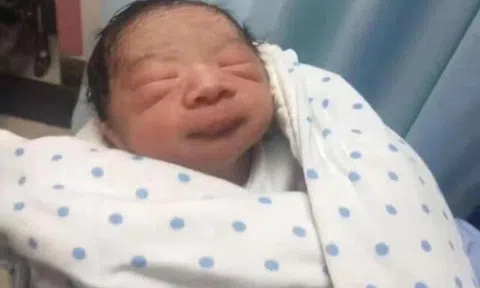 Bé sơ sinh chào đời da nhăn nheo như “khỉ con”, nửa năm sau bố mẹ kinh ngạc không nhận ra đứa trẻ ngày nào