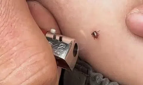 Con gái bị sinh vật lạ cắn vào cổ, bố 2 lần muốn cứu nhưng mẹ từ chối, bác sĩ khen: Mẹ đúng!