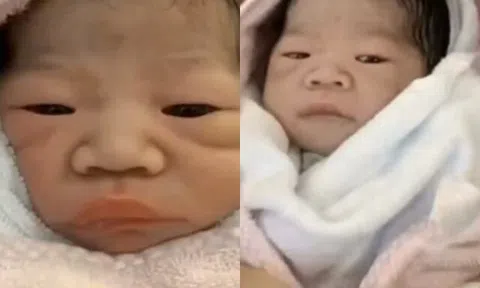 Bé gái chào đời bị họ hàng chê xấu dù bố mẹ đẹp, vài tháng sau lột xác nhận không ra