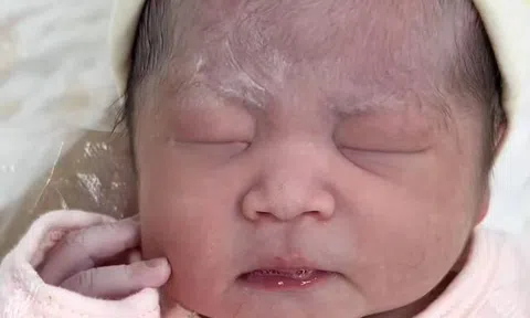 Con sinh 3 ngày vẫn không chịu mở mắt, nhận kết quả khám của bác sĩ bố mẹ mới biết do di truyền