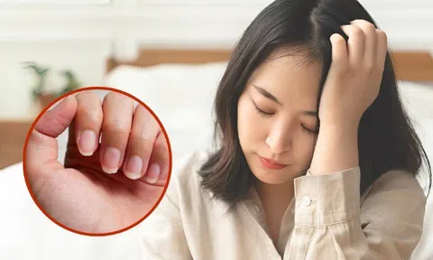 Màu sắc móng tay tiết lộ gì về sức khỏe của bạn? Kiểm tra ngay để biết được tình hình của bản thân