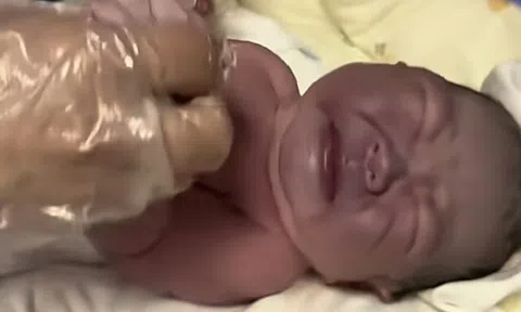 Bà bầu muốn con trắng trẻo nên ngày nào cũng ăn một thứ, phát hoảng khi em bé chào đời da tím sẫm, nặng 4kg