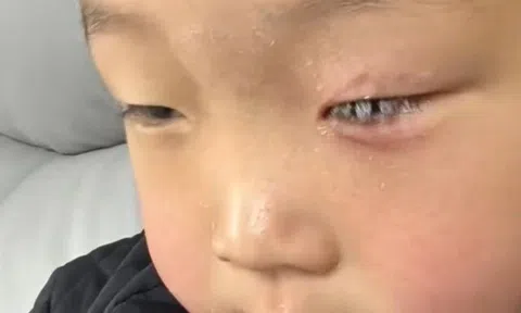 Con bị keo 502 bắn vào mắt, bố nhẹ nhàng đổ thêm một thứ, bác sĩ khen: Hiếm có người thông minh như anh!