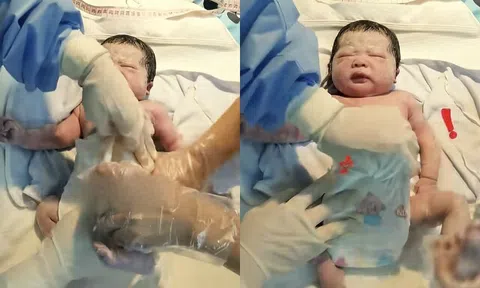Bé sơ sinh chào đời bị bác sĩ và y tá liên tục tác động ngay trên bàn mổ, người mẹ rối rít cảm ơn