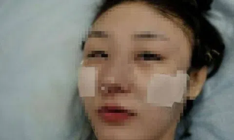 Phú bà U50 phẫu thuật thẩm mỹ để săn “hồng hài nhi” 19 tuổi, cái kết đắng lòng khi bác sĩ thông báo mang thai