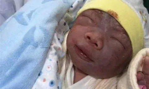 Mẹ muốn khóc khi con sơ sinh chào đời tím tái như “củ khoai môn”, 3 tháng sau “lột xác” xinh như búp bê