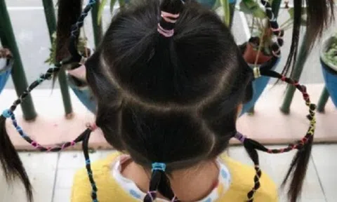 Con gái đi học về mỗi ngày một kiểu tóc nhưng liên tục nói đau đầu, mẹ nhắn tin cho cô giáo thì sốc trước câu trả lời