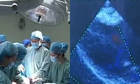 Mang thai 8 tháng, mẹ bầu nhập viện sinh mổ nhưng bác sĩ không thấy thai nhi đâu, lý do khiến nhiều người sợ hãi