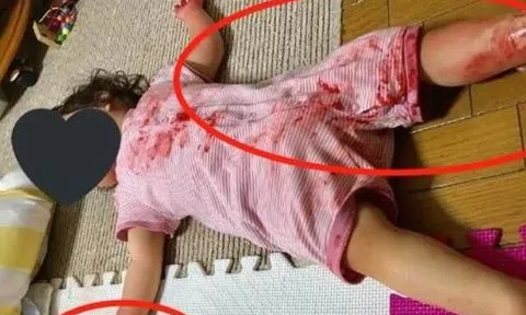 Ra ngoài 10 phút trở về, vừa mở cửa nhà thấy con gái người dính “đầy máu”, người mẹ suýt ngất