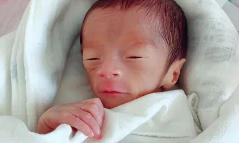 Con chào đời mặt teo hóp trông như quả mận, người mẹ buồn lòng, không ngờ giờ đứa trẻ lột xác khó tin