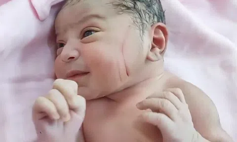 Vừa rời phòng đẻ phát hiện nhiều vết thương trên mặt con sơ sinh, gia đình nghi ngờ bác sĩ tắc trách, đòi kiện