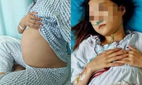 Nữ sinh đau bụng kinh liền đến bệnh viện khám, vừa cởi đồ bác sĩ hốt hoảng thấy đầu thai nhi sắp ra