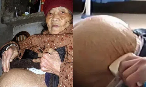 Bà lão 91 tuổi trượt chân ngã, siêu âm lại thấy thai nhi trong bụng, con trai khóc nghẹn: "Bố tôi mất 60 năm nay rồi!"