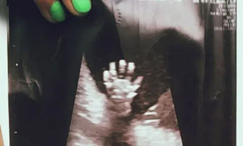 Mẹ bầu đi siêu âm thai, ngạc nhiên thấy em bé trong bụng giơ bàn tay 5 ngón, nghe bác sĩ nói liền xúc động