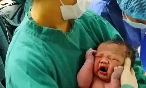 Con sinh ra ngoại hình khác lạ bố sợ không dám bế, bác sĩ đỡ đẻ lại báo tin vui: "Quá may mắn, chúc mừng gia đình"