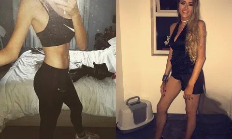 Mang thai 9 tháng nhưng cô gái trẻ không biết có bầu vì bụng phẳng lì, cho đến khi bác sĩ ấn tay vào bụng liền to lên