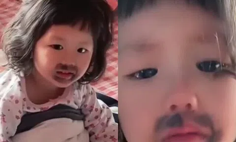 Ngủ dậy thấy miệng mọc vết bầm đen, bé gái khóc thét, mẹ phát hiện nguyên nhân từ món con ăn mỗi ngày