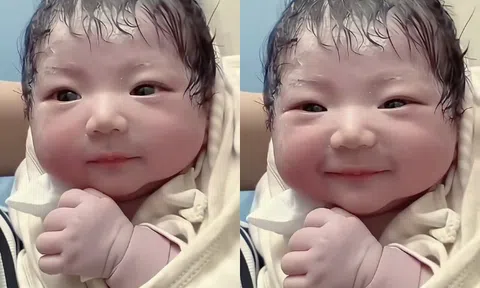 Bé sơ sinh chào đời đẹp như búp bê khiến cõi mạng xôn xao, y tá nói: “Đứa trẻ đã phẫu thuật thẩm mỹ”