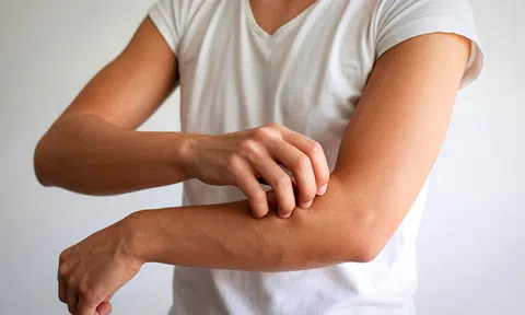 Ngứa kéo dài không rõ nguyên nhân: Cảnh báo sớm suy thận nhiều người bỏ qua