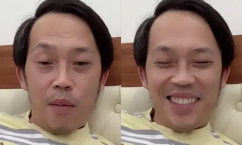 NSƯT Hoài Linh bất ngờ livestream giữa đêm khuya với gương mặt khác lạ, phủ nhận bị "hack" Facebook