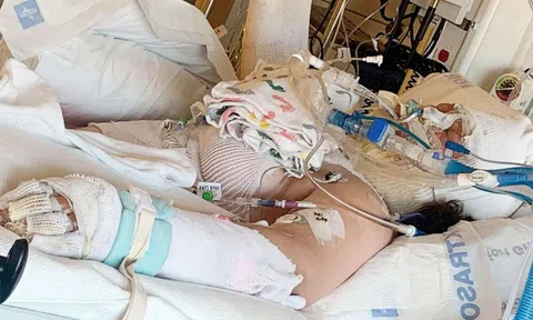 Bé gái 13 tuổi bỏng nặng do làm theo thử thách trên TikTok